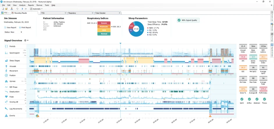 Nox t3s software - Noxturnal 6.0
